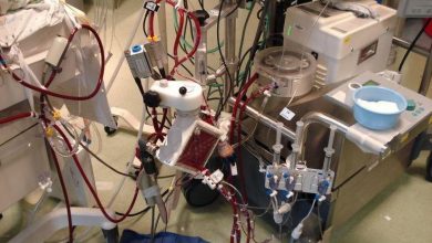 Extracorporeal Membrane Oxygenation (ECMO) Systems